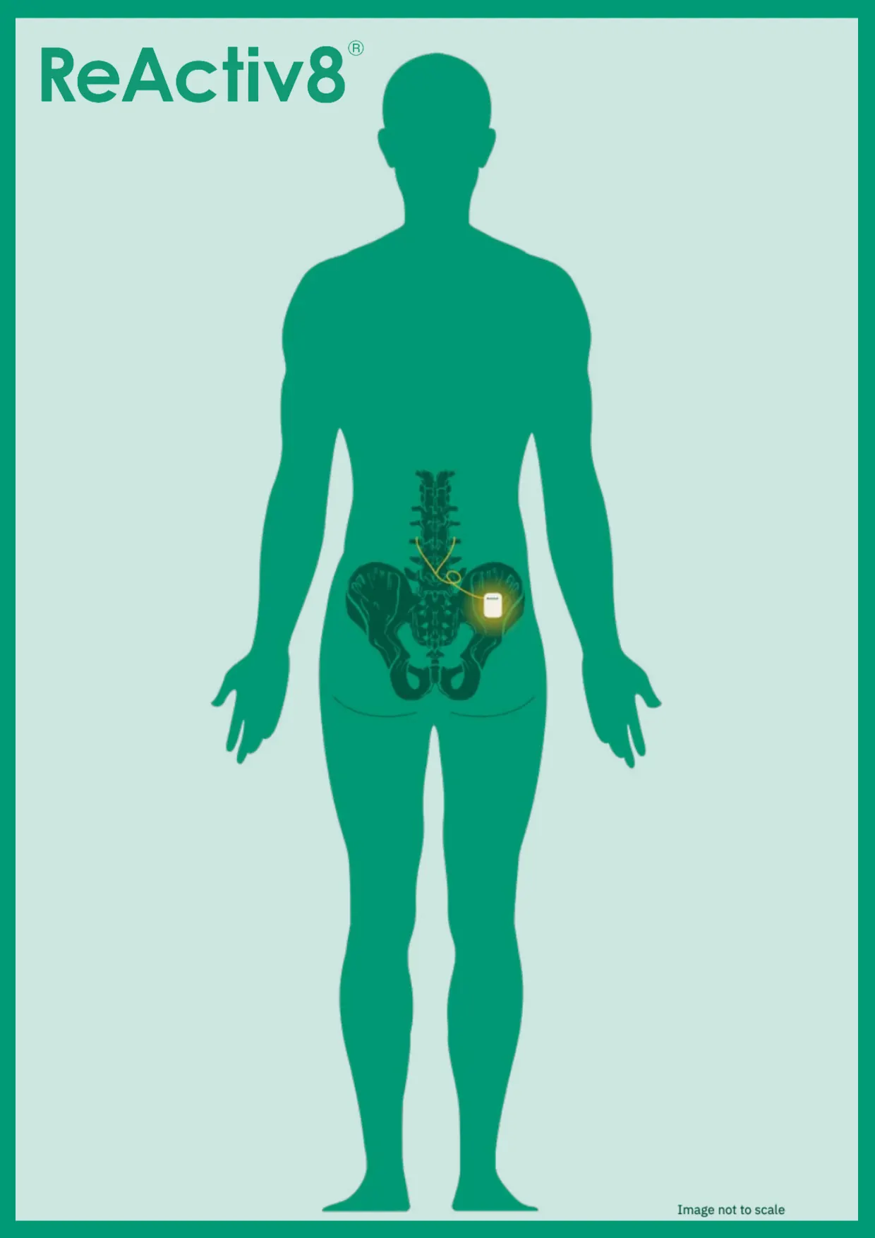 ReActiv8 booklet, page 7 of 16: Where the ReActiv8 device sits in the body